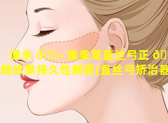 原永 🌻 康美莱直丝弓正 💐 畸效果持久性解密(直丝弓矫治器的特点和基本原理)